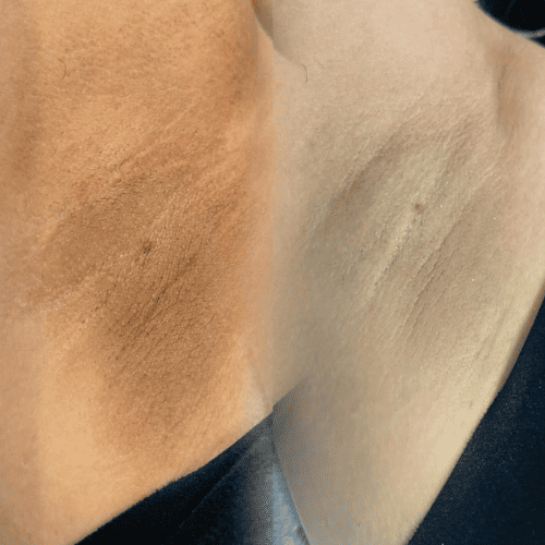 Snaydelin Plascencia